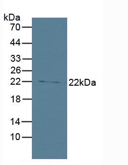 Rabbit Anti-Human Bid Polyclonal Antibody (CABT-L2104)