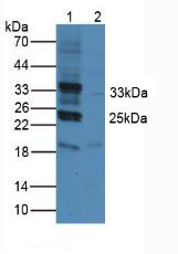 Rabbit Anti-Human PDCD1LG1 Polyclonal Antibody (CABT-L2061)