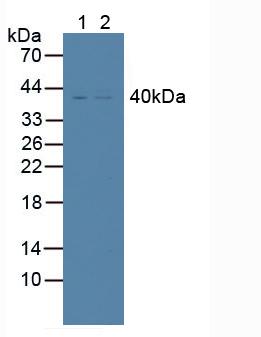 Rabbit Anti-Human TNFRSF10B Polyclonal Antibody (CABT-L2069)