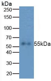 Rabbit Anti-Human CASP8 Polyclonal Antibody (CABT-L2294)