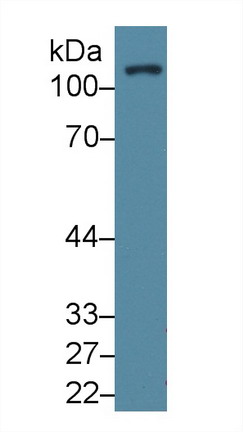 Rabbit Anti-Human FAK Polyclonal Antibody (CABT-L2131)