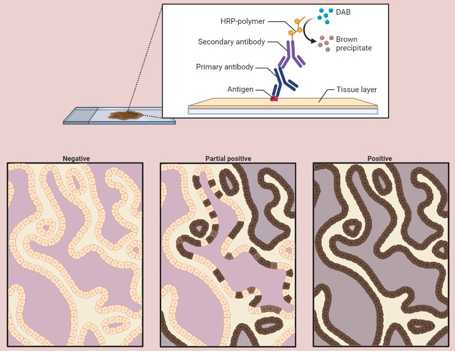 IHC/Pathology Antibodies