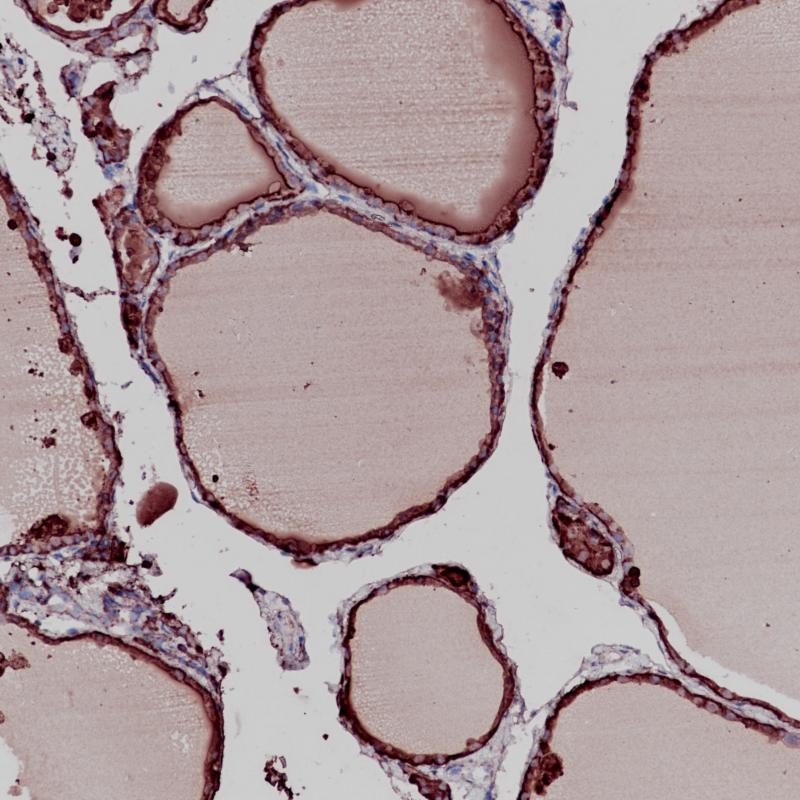 Recombinant Rabbit Anti-Human TG Monoclonal Antibody, clone CQ7178 (CABT-Z234R)