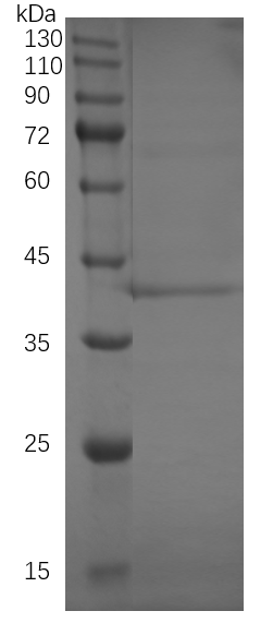 Recombinant Human Zinc transporter 8 [His] (DAGC025)