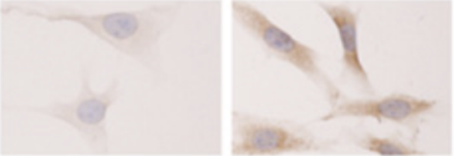 Mouse Anti-PI(3,4,5)P3 monoclonal antibody, clone SD7G9 [FITC] (DMABB-JX87)