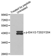 ERK1/ERK2 (T202, Y204) antibody