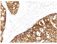 IHC/Pathology Antibodies