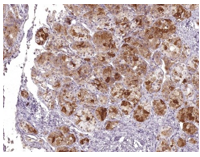 IHC/Pathology Antibodies