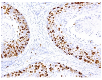 IHC/Pathology Antibodies