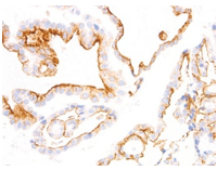 IHC/Pathology Antibodies