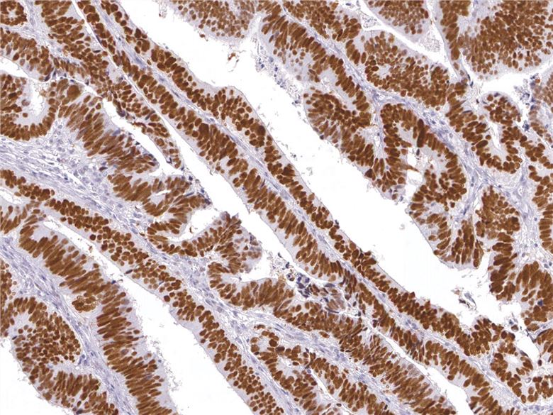 Mouse Anti-Human p53 monoclonal antibody, clone JID164 (CABT-L2805)