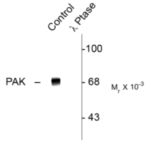 PAK1 + PAK2 + PAK3 (T402) polyclonal antibody