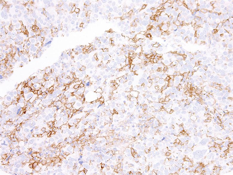 Mouse Anti-Human PD-L1 monoclonal antibody, clone JID522 (CABT-L2928)