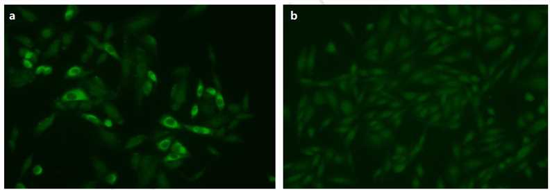 Phospholipase A2 receptor (PLA2R) and THSD7A stable cell line