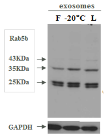 Western Blot comparison of exosomal markers on fresh (F), frozen (-20</strong><strong>°C) and lyophilized exosomes